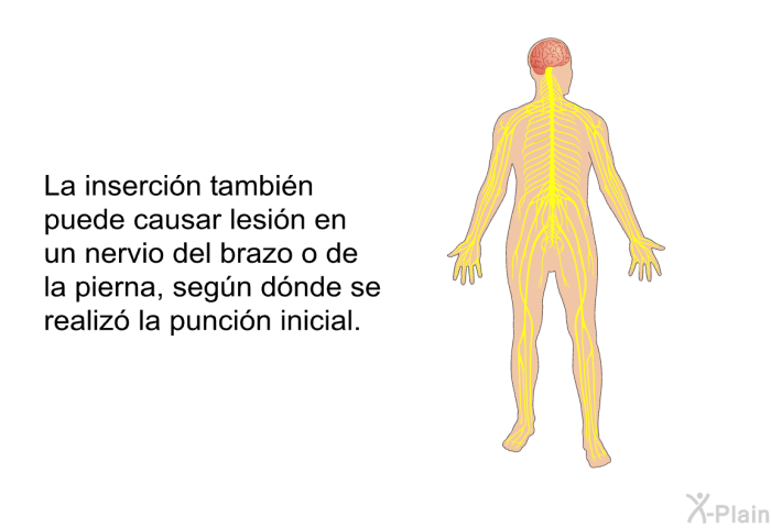 La insercin tambin puede causar lesin en un nervio del brazo o de la pierna, segn dnde se realiz la puncin inicial.