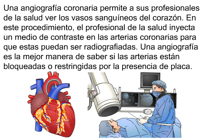 Una angiografa coronaria permite a sus profesionales de la salud ver los vasos sanguneos del corazn. En este procedimiento, el profesional de la salud inyecta un medio de contraste en las arterias coronarias para que estas puedan ser radiografiadas. Una angiografa es la mejor manera de saber si las arterias estn bloqueadas o restringidas por la presencia de placa.