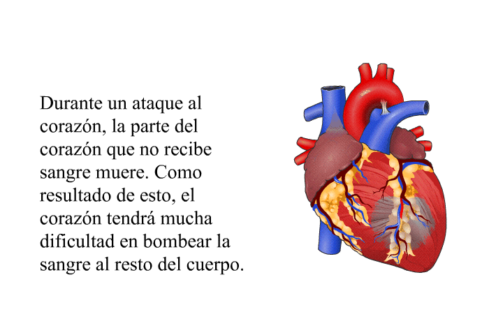 Durante un ataque al coraz�n, la parte del coraz�n que no recibe sangre muere. Como resultado de esto, el coraz�n tendr� mucha dificultad en bombear la sangre al resto del cuerpo.