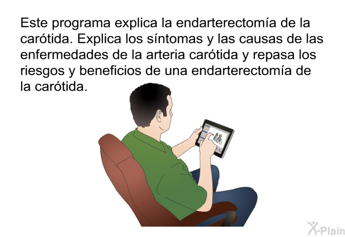 Esta informacin acerca de su salud explica la endarterectoma de la cartida. Explica los sntomas y las causas de las enfermedades de la arteria cartida y repasa los riesgos y beneficios de una endarterectoma de la cartida.