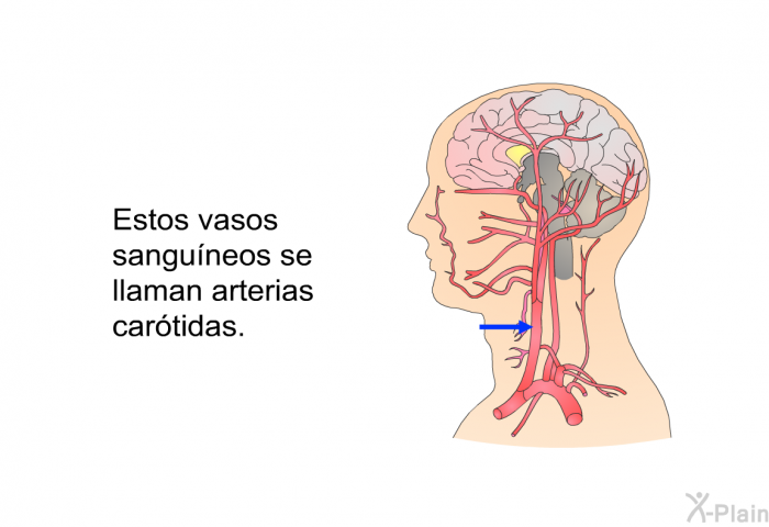 Estos vasos sanguneos se llaman arterias cartidas.