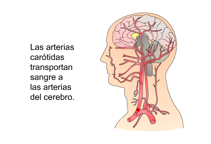 Las arterias cartidas transportan sangre a las arterias del cerebro.