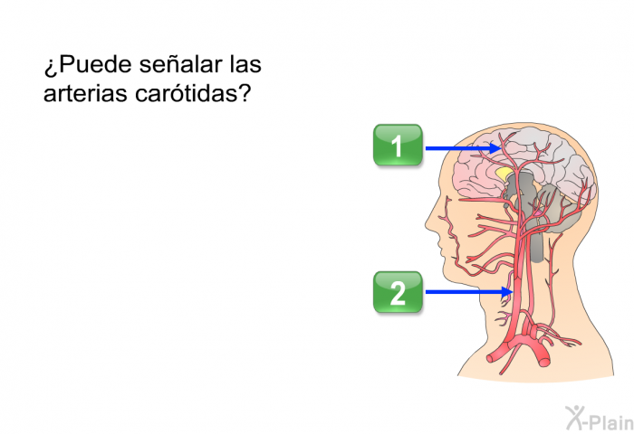 ¿Puede sealar las arterias cartidas?