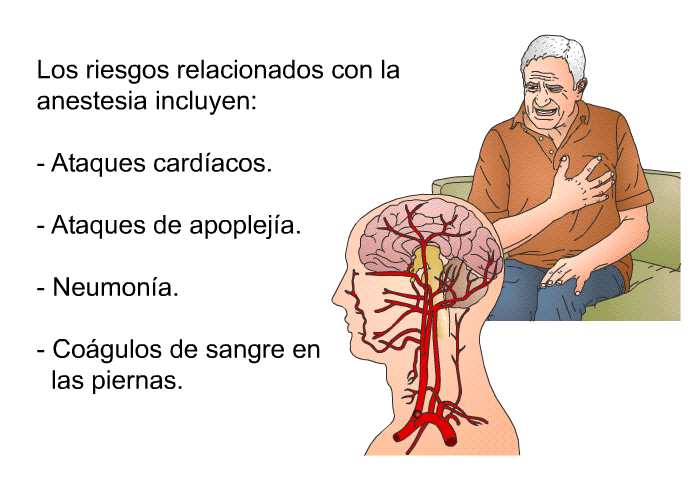 Los riesgos relacionados con la anestesia incluyen:  Ataques cardacos. Ataques de apopleja. Neumona. Cogulos de sangre en las piernas.
