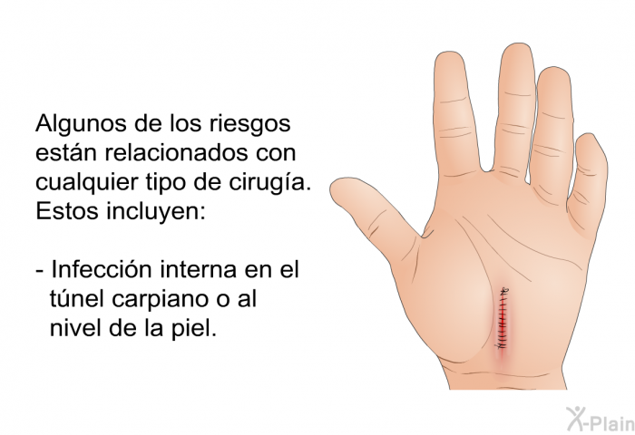 Algunos de los riesgos estn relacionados con cualquier tipo de ciruga. Estos incluyen:  Infeccin interna en el tnel carpiano o al nivel de la piel.