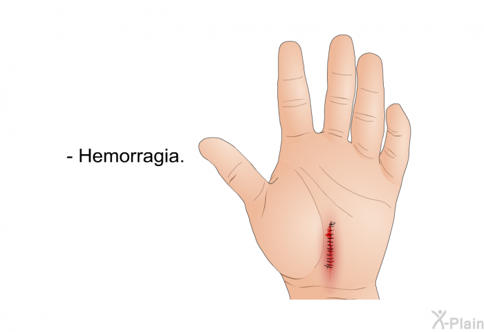 Hemorragia.