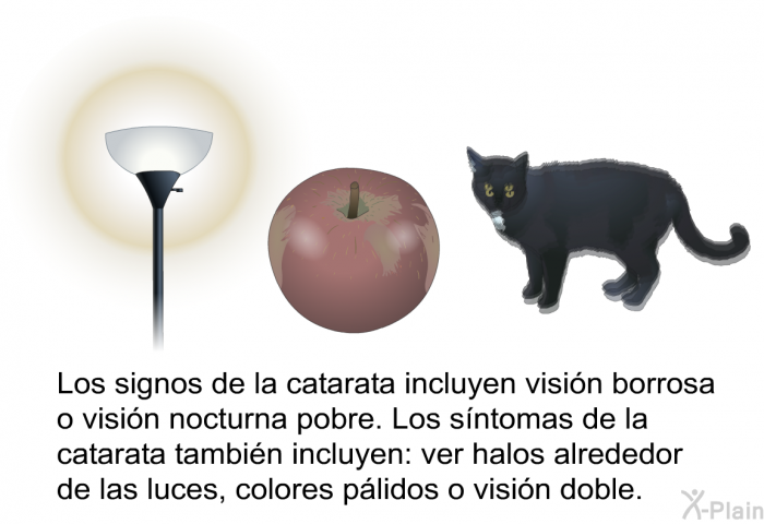 Los signos de la catarata incluyen visi�n borrosa o visi�n nocturna pobre. Los s�ntomas de la catarata tambi�n incluyen: ver halos alrededor de las luces, colores p�lidos o visi�n doble.