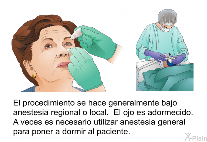 El procedimiento se hace generalmente bajo anestesia regional o local. El ojo es adormecido. A veces es necesario utilizar anestesia general para poner a dormir al paciente.