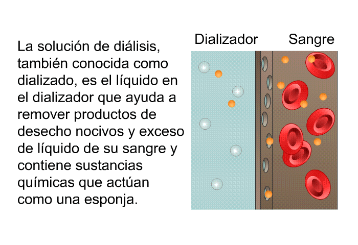 La solucin de dilisis, tambin conocida como dializado, es el lquido en el dializador que ayuda a remover productos de desecho nocivos y exceso de lquido de su sangre y contiene sustancias qumicas que actan como una esponja.