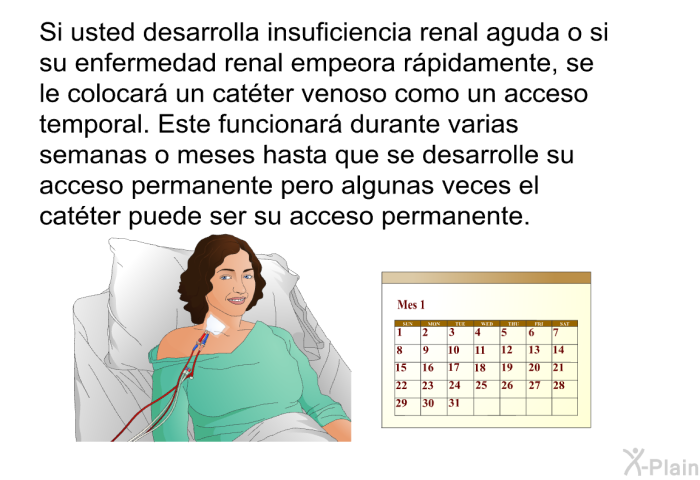 Si usted desarrolla insuficiencia renal aguda o si su enfermedad renal empeora rpidamente, se le colocar un catter venoso como un acceso temporal. Este funcionar durante varias semanas o meses hasta que se desarrolle su acceso permanente pero algunas veces el catter puede ser su acceso permanente.