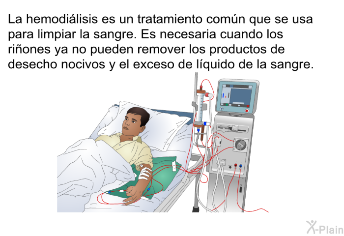 La hemodilisis es un tratamiento comn que se usa para limpiar la sangre. Es necesaria cuando los riones ya no pueden remover los productos de desecho nocivos y el exceso de lquido de la sangre.