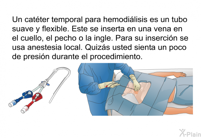 Un catter temporal para hemodilisis es un tubo suave y flexible. Este se inserta en una vena en el cuello, el pecho o la ingle. Para su insercin se usa anestesia local. Quizs usted sienta un poco de presin durante el procedimiento.