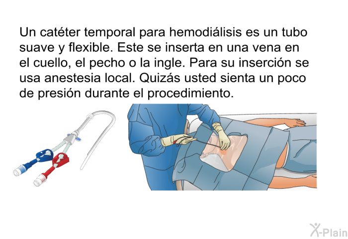 Un catter temporal para hemodilisis es un tubo suave y flexible. Este se inserta en una vena en el cuello, el pecho o la ingle. Para su insercin se usa anestesia local. Quizs usted sienta un poco de presin durante el procedimiento.