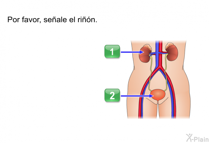 Por favor, seale el rin.