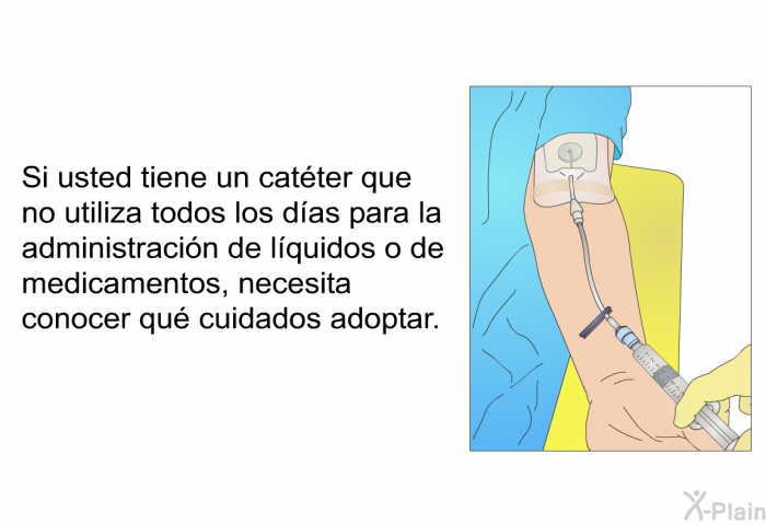 Si usted tiene un catter que no utiliza todos los das para la administracin de lquidos o de medicamentos, necesita conocer qu cuidados adoptar.