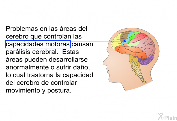 Problemas en las reas del cerebro que controlan las capacidades motoras causan parlisis cerebral. Estas reas pueden desarrollarse anormalmente o sufrir dao, lo cual trastorna la capacidad del cerebro de controlar movimiento y postura.