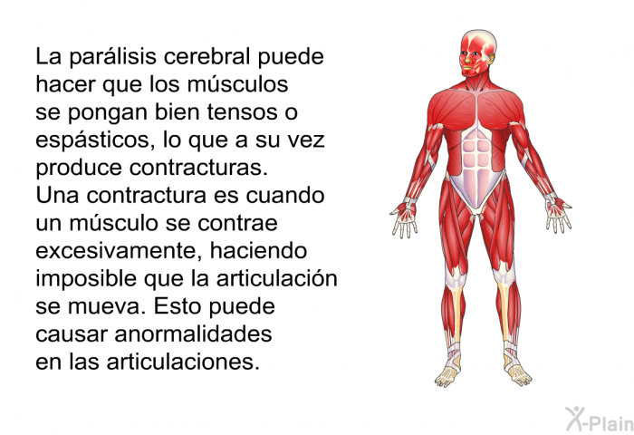 La par�lisis cerebral puede hacer que los m�sculos se pongan bien tensos o esp�sticos, lo que a su vez produce contracturas. Una contractura es cuando un m�sculo se contrae excesivamente, haciendo imposible que la articulaci�n se mueva. Esto puede causar anormalidades en las articulaciones.