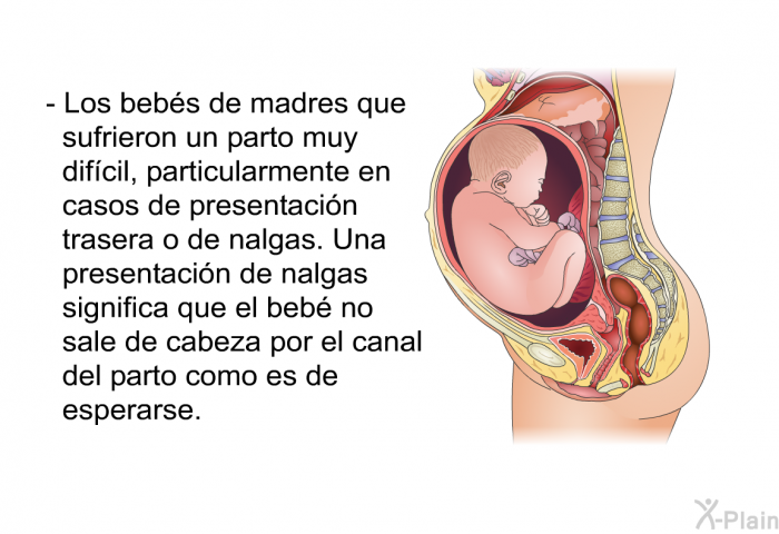 Los bebs de madres que sufrieron un parto muy difcil, particularmente en casos de presentacin trasera o de nalgas. Una presentacin de nalgas significa que el beb no sale de cabeza por el canal del parto como es de esperarse.