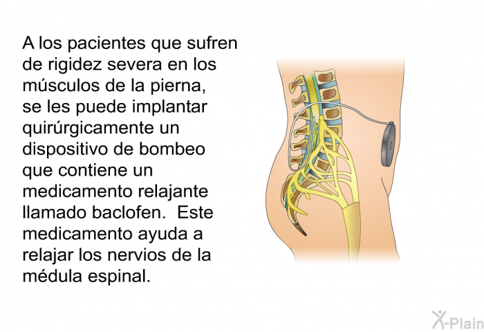 A los pacientes que sufren de rigidez severa en los msculos de la pierna, se les puede implantar quirrgicamente un dispositivo de bombeo que contiene un medicamento relajante llamado baclofen. Este medicamento ayuda a relajar los nervios de la mdula espinal.