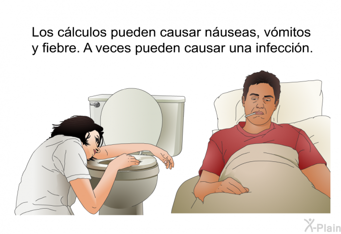 Los clculos pueden causar nuseas, vmitos y fiebre. A veces pueden causar una infeccin.