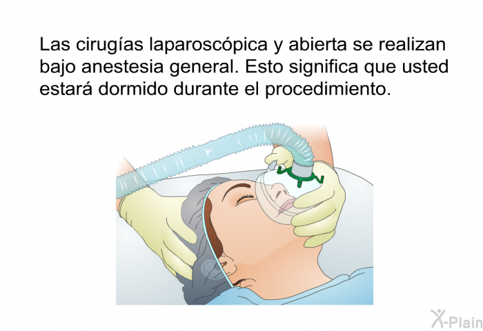 Las cirugas laparoscpica y abierta se realizan bajo anestesia general. Esto significa que usted estar dormido durante el procedimiento.