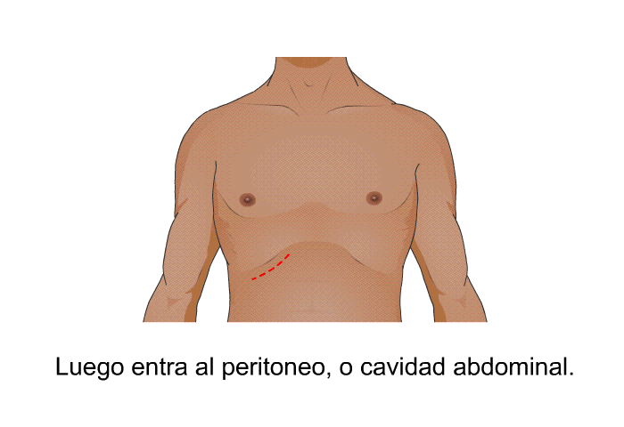 Luego entra al peritoneo, o cavidad abdominal.