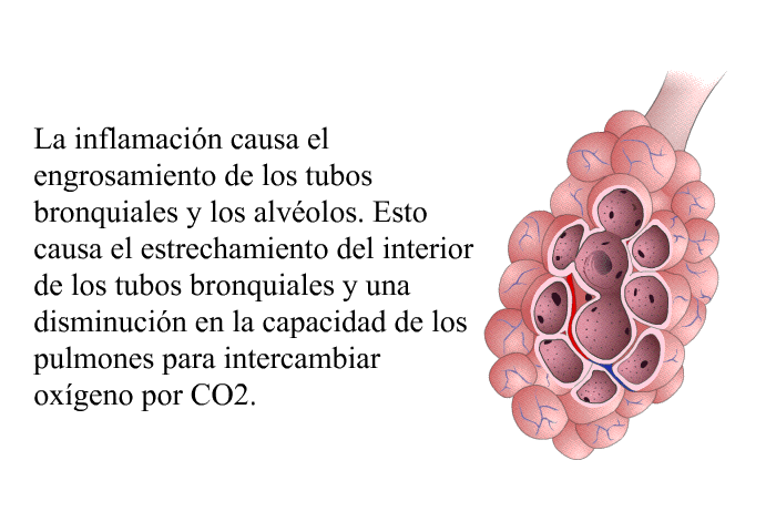 La inflamacin causa el engrosamiento de los tubos bronquiales y los alvolos. Esto causa el estrechamiento del interior de los tubos bronquiales y una disminucin en la capacidad de los pulmones para intercambiar oxgeno por CO<SUB>2</SUB>.