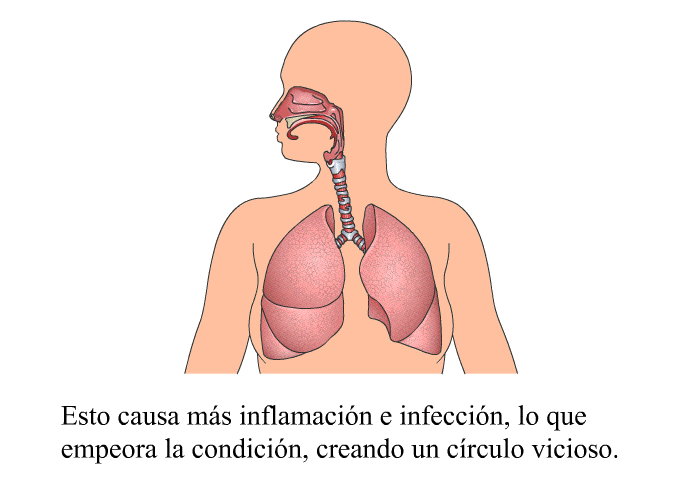 Esto causa ms inflamacin e infeccin, lo que empeora la condicin, creando un crculo vicioso.