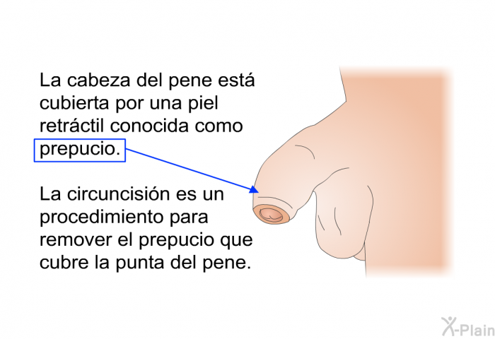 La cabeza del pene est cubierta por una piel retrctil conocida como prepucio. La circuncisin es un procedimiento para remover el prepucio que cubre la punta del pene.