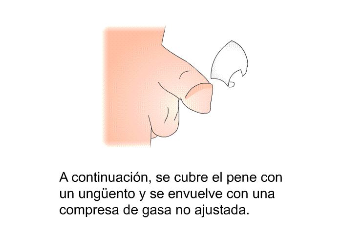 A continuacin, se cubre el pene con un ungüento y se envuelve con una compresa de gasa no ajustada.