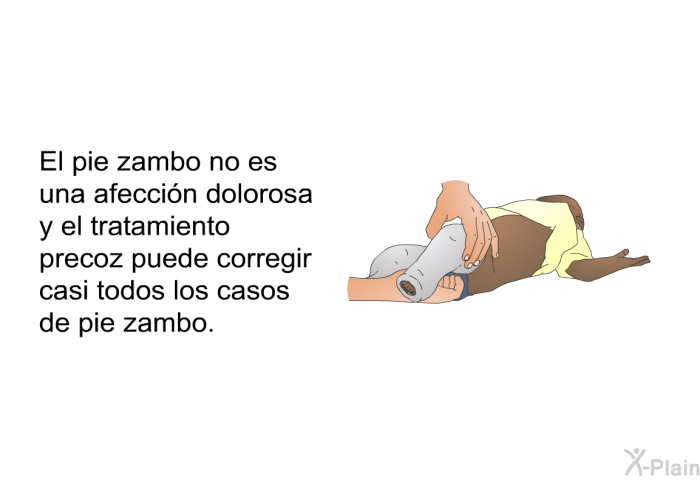 El pie zambo no es una afeccin dolorosa y el tratamiento precoz puede corregir casi todos los casos de pie zambo.