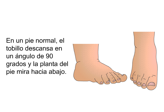 En un pie normal, el tobillo descansa en un ngulo de 90 grados y la planta del pie mira hacia abajo.