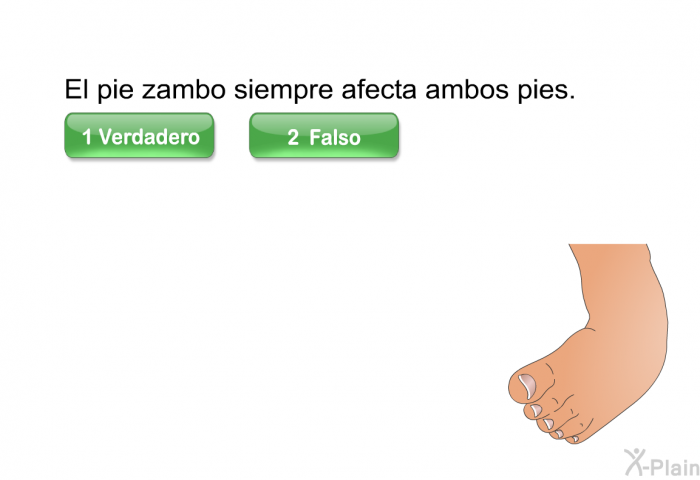 El pie zambo siempre afecta ambos pies.