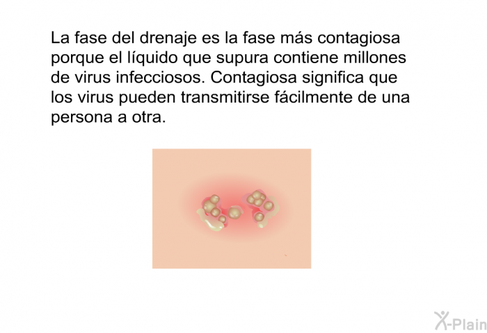 La fase del drenaje es la fase ms contagiosa porque el lquido que supura contiene millones de virus infecciosos. <I>Contagiosa</I> significa que los virus pueden transmitirse fcilmente de una persona a otra.