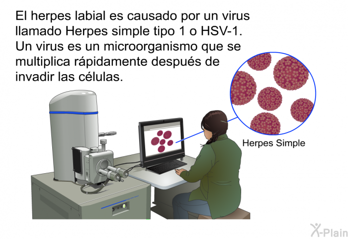 El herpes labial es causado por un virus llamado Herpes simple tipo 1 o HSV-1. Un virus es un microorganismo que se multiplica rpidamente despus de invadir las clulas.
