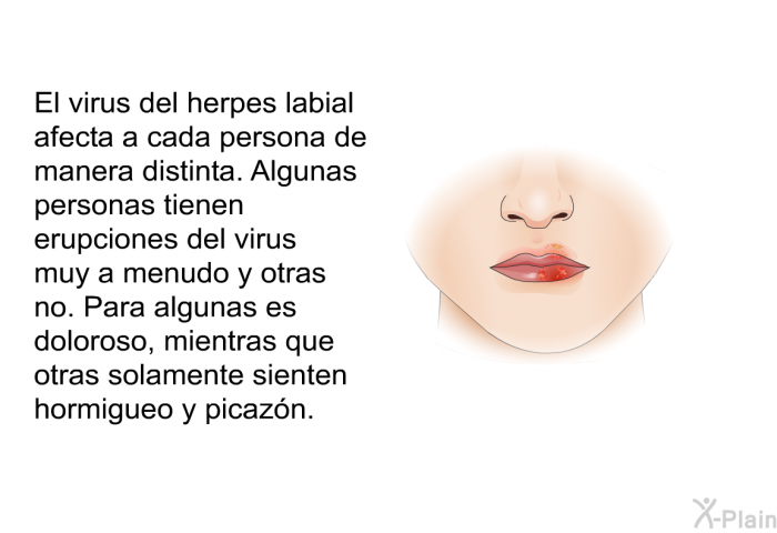 El virus del herpes labial afecta a cada persona de manera distinta. Algunas personas tienen erupciones del virus muy a menudo y otras no. Para algunas es doloroso, mientras que otras solamente sienten hormigueo y picazn.