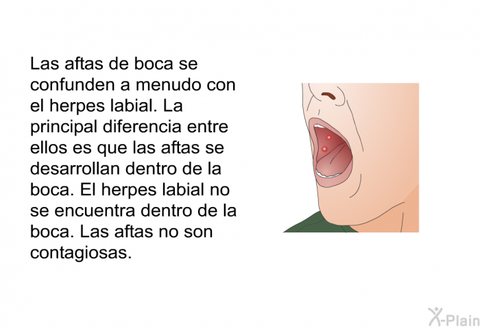 Las aftas de boca se confunden a menudo con el herpes labial. La principal diferencia entre ellos es que las aftas se desarrollan dentro de la boca. El herpes labial no se encuentra dentro de la boca. Las aftas no son contagiosas.