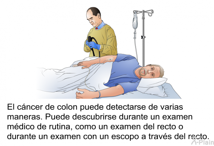 El cncer de colon puede detectarse de varias maneras. Puede descubrirse durante un examen mdico de rutina, como un examen del recto o durante un examen con un escopo a travs del recto.