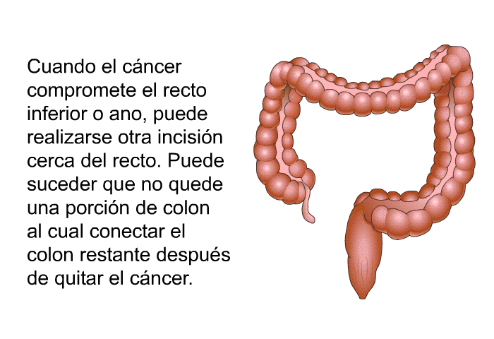 Cuando el cncer compromete el recto inferior o ano, puede realizarse otra incisin cerca del recto. Puede suceder que no quede una porcin de colon al cual conectar el colon restante despus de quitar el cncer.