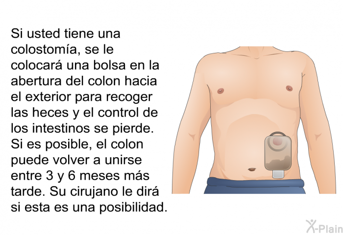 Si usted tiene una colostoma, se le colocar una bolsa en la abertura del colon hacia el exterior para recoger las heces y el control de los intestinos se pierde. Si es posible, el colon puede volver a unirse entre 3 y 6 meses ms tarde. Su cirujano le dir si esta es una posibilidad.