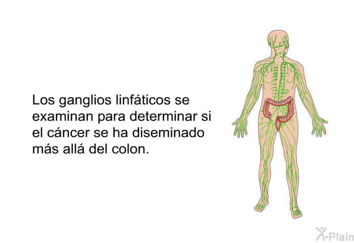 Los ganglios linfticos se examinan para determinar si el cncer se ha diseminado ms all del colon.