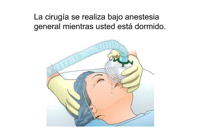 La ciruga se realiza bajo anestesia general mientras usted est dormido.