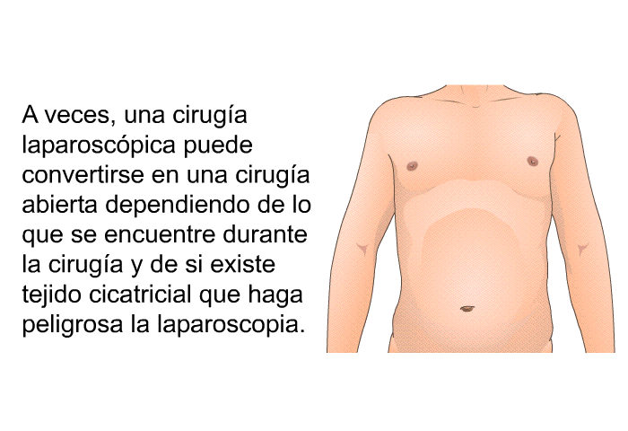 A veces, una ciruga laparoscpica puede convertirse en una ciruga abierta dependiendo de lo que se encuentre durante la ciruga y de si existe tejido cicatricial que haga peligrosa la laparoscopia.