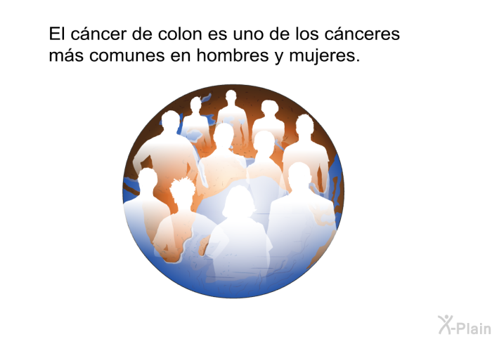 El cncer de colon es uno de los cnceres ms comunes en hombres y mujeres.