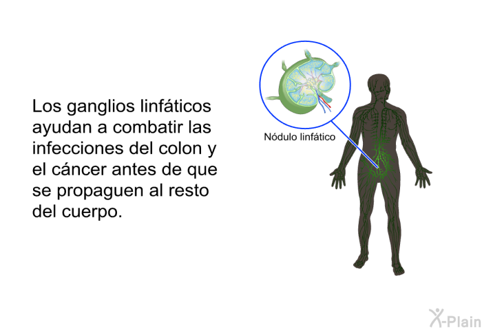 Los ganglios linfticos ayudan a combatir las infecciones del colon y el cncer antes de que se propaguen al resto del cuerpo.