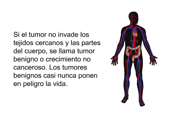 Si el tumor no invade los tejidos cercanos y las partes del cuerpo, se llama <I>tumor benigno</I> o <I>crecimiento no canceroso</I>. Los tumores benignos casi nunca ponen en peligro la vida.