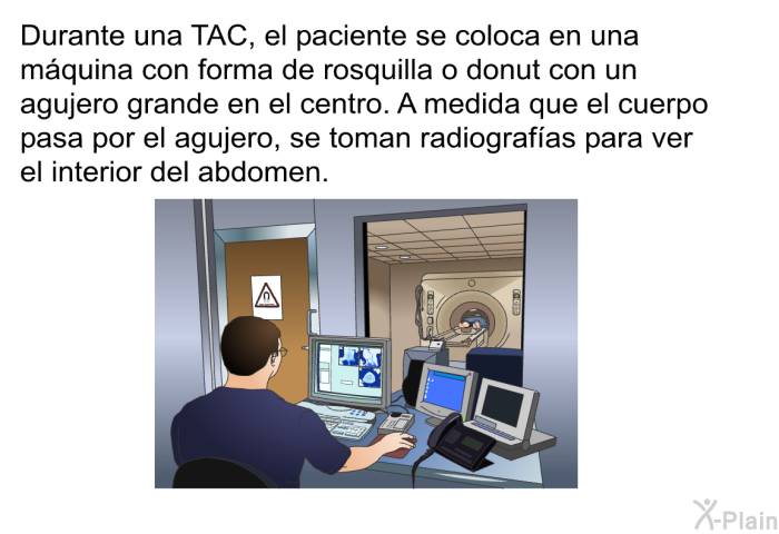 Durante una TAC, el paciente se coloca en una m�quina con forma de rosquilla o donut con un agujero grande en el centro. A medida que el cuerpo pasa por el agujero, se toman radiograf�as para ver el interior del abdomen.