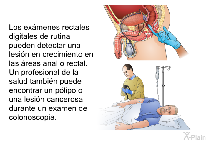 Los ex�menes rectales digitales de rutina pueden detectar una lesi�n en crecimiento en las �reas anal o rectal. Un profesional de la salud tambi�n puede encontrar un p�lipo o una lesi�n cancerosa durante un examen de colonoscopia.