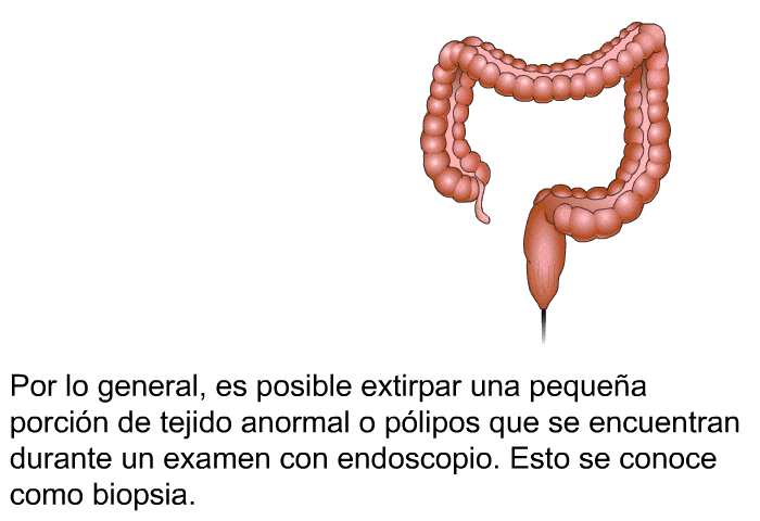 Por lo general, es posible extirpar una peque�a porci�n de tejido anormal o p�lipos que se encuentran durante un examen con endoscopio. Esto se conoce como <I>biopsia</I>.