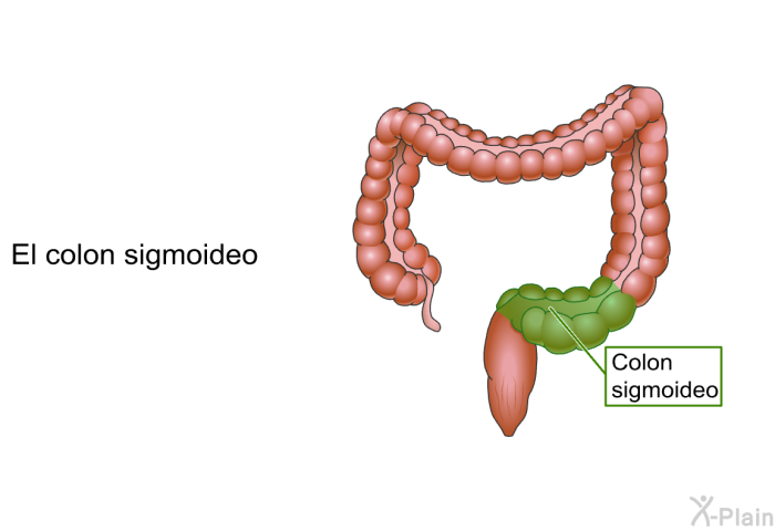 El colon sigmoideo